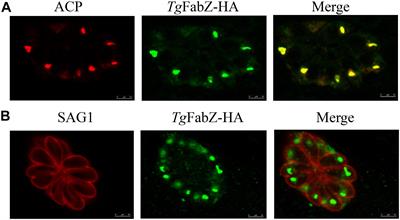 The Role of Type II Fatty Acid Synthesis Enzymes FabZ, ODSCI, and ODSCII in the Pathogenesis of Toxoplasma gondii Infection